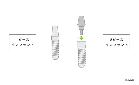 1ピースインプラント・2ピースインプラントのイメージ図